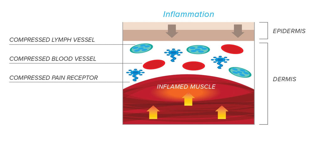 CBD education is one of the things we do best. Using CBD in our products aids in healing and recovery from inflammation and soreness. Understanding the benefits of CBD products is key to a healthier lifestyle and controlling pain